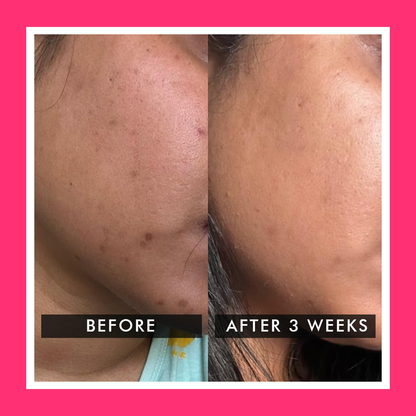 Aroos Organic Whitening Cream