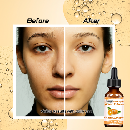 Aroos Organic Vitamin C Serum